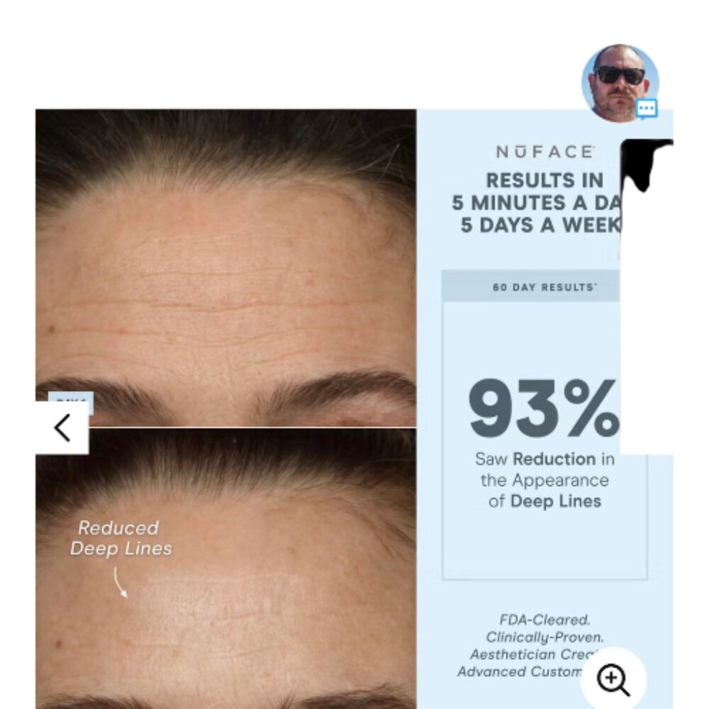 NuFace Effective Lip & Eye Attachment for Trinity+ Microcurrent Device *NEW - Picture 4 of 4
